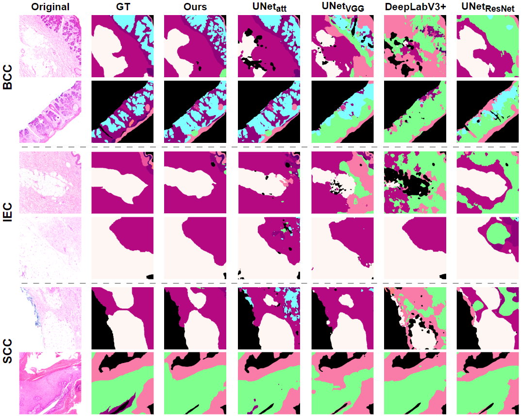 Qualitative Comparison